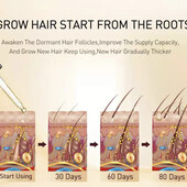 Средство для роста волос Purc Ginger Essentials, спреи для мужчин и женщин